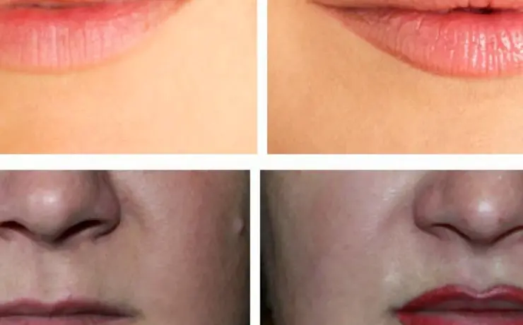 Перманентный макияж тонких губ